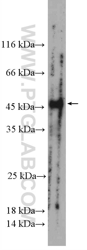Western Blot (WB) analysis of mouse small intestine tissue using LMBRD1 Polyclonal antibody (27203-1-AP)