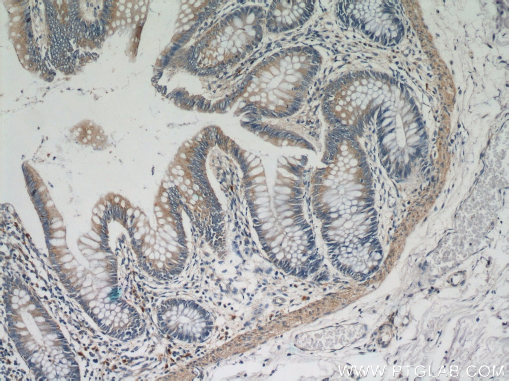 Immunohistochemistry (IHC) staining of human colon tissue using LMBRD2 Polyclonal antibody (21767-1-AP)