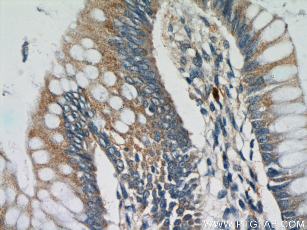 Immunohistochemistry (IHC) staining of human colon tissue using LMBRD2 Polyclonal antibody (21767-1-AP)
