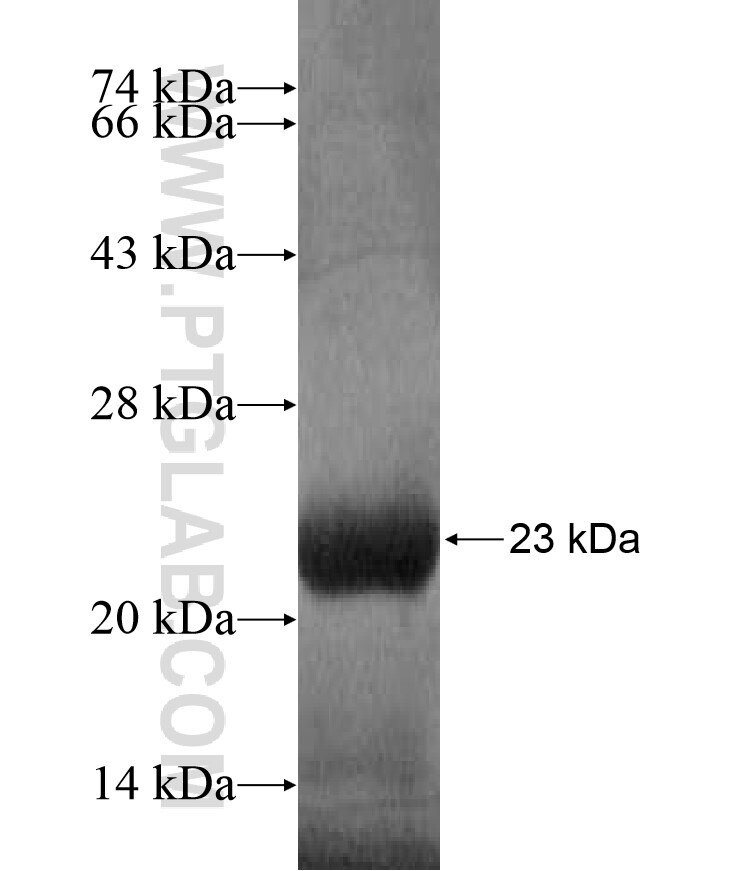 LMBRD2 fusion protein Ag17072 SDS-PAGE