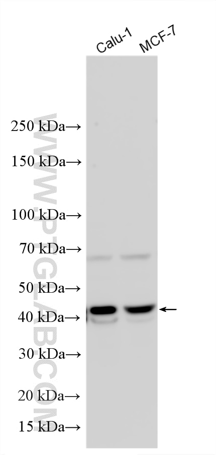 Western Blot (WB) analysis of various lysates using LMCD1 Polyclonal antibody (15175-1-AP)