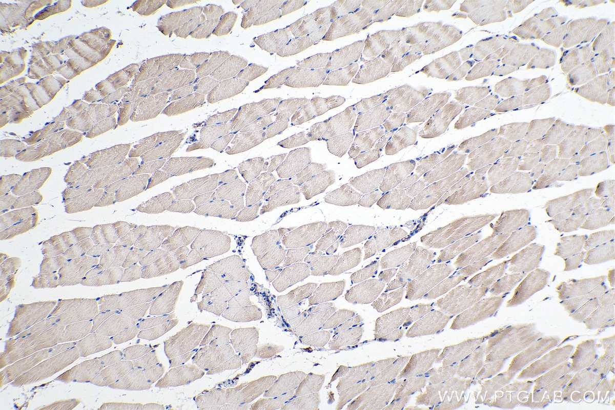 Immunohistochemistry (IHC) staining of mouse skeletal muscle tissue using LMCD1 Monoclonal antibody (67834-1-Ig)