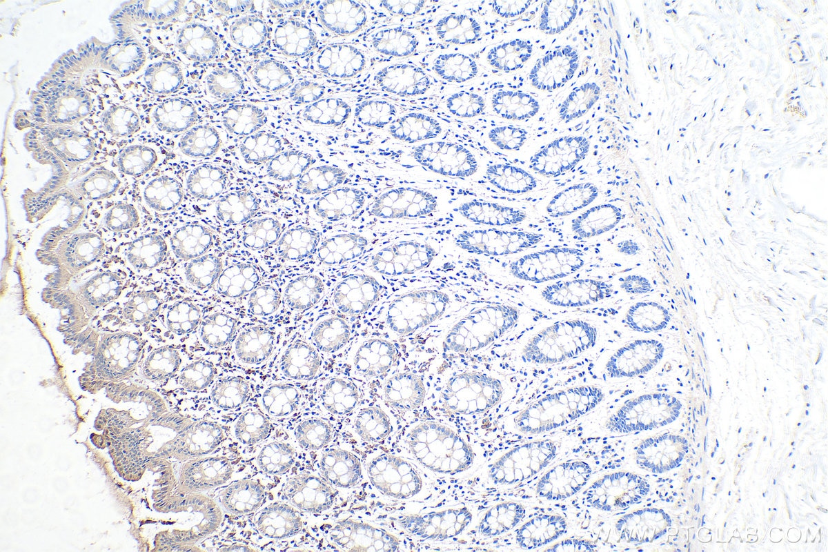 Immunohistochemistry (IHC) staining of human colon tissue using LMCD1 Monoclonal antibody (67834-1-Ig)
