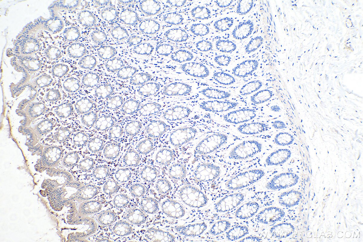 IHC staining of human colon using 67834-1-Ig