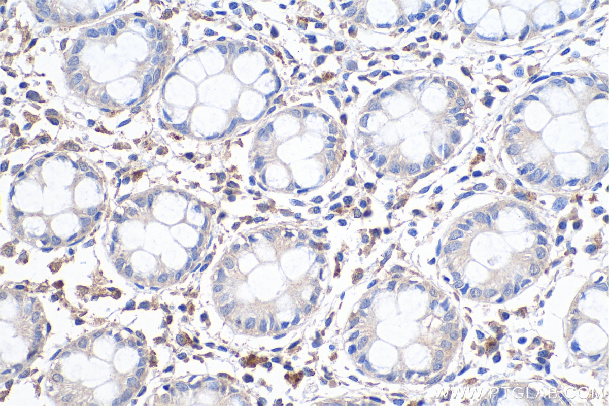 Immunohistochemistry (IHC) staining of human colon tissue using LMCD1 Monoclonal antibody (67834-1-Ig)