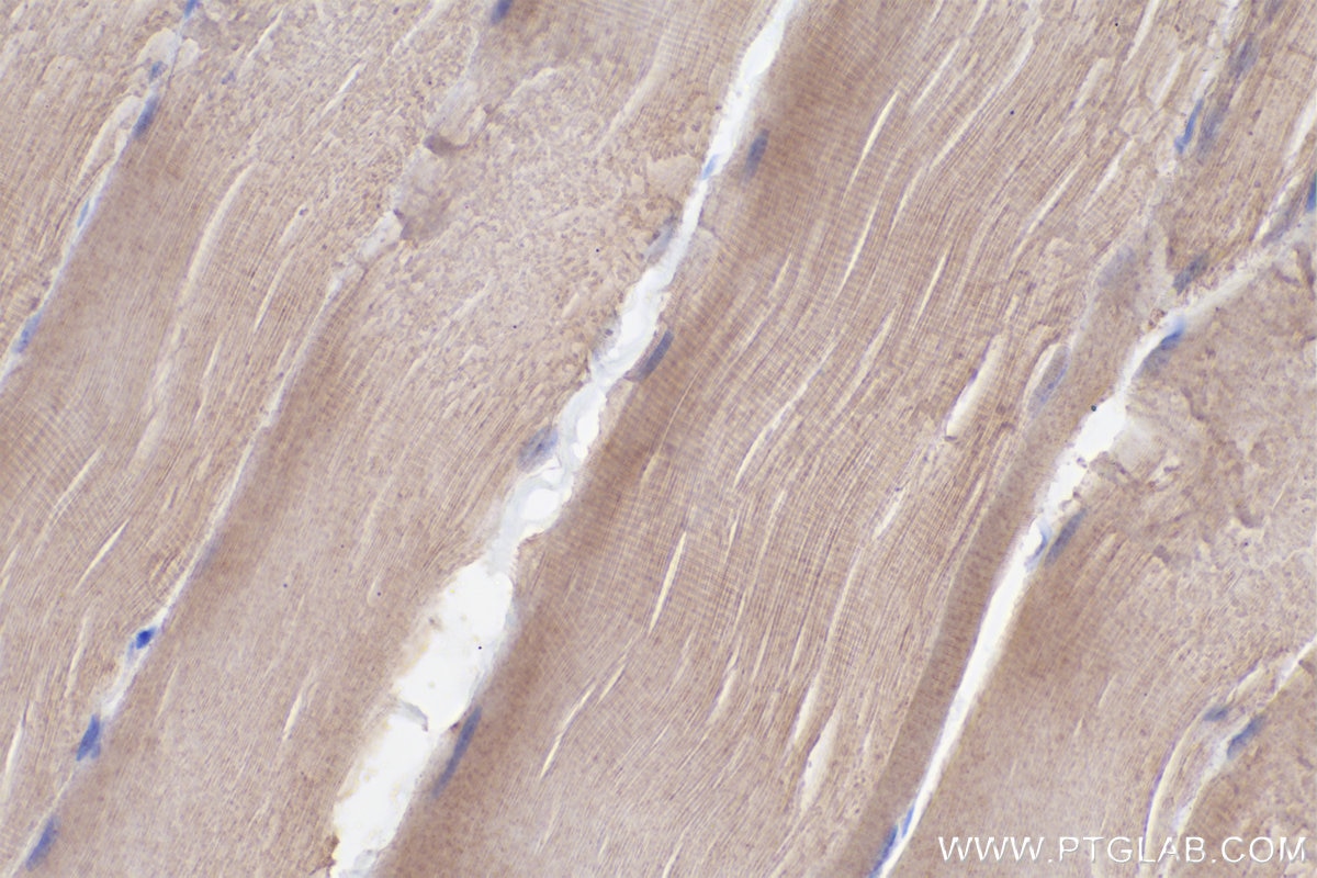 IHC staining of rat skeletal muscle using 67834-1-Ig