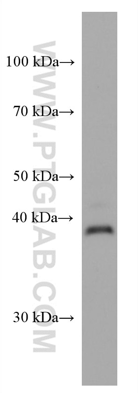 Western Blot (WB) analysis of human placenta tissue using LMCD1 Monoclonal antibody (67834-1-Ig)