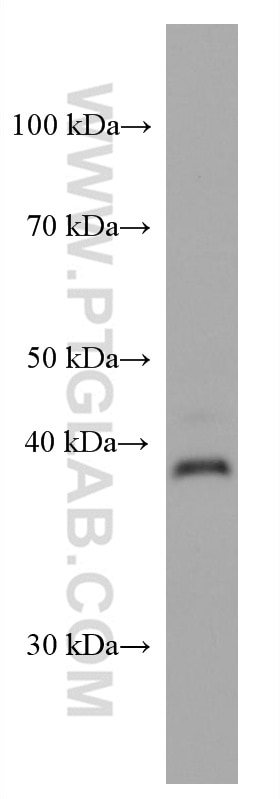 WB analysis of human placenta using 67834-1-Ig