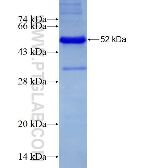 LMCD1 fusion protein Ag28331 SDS-PAGE