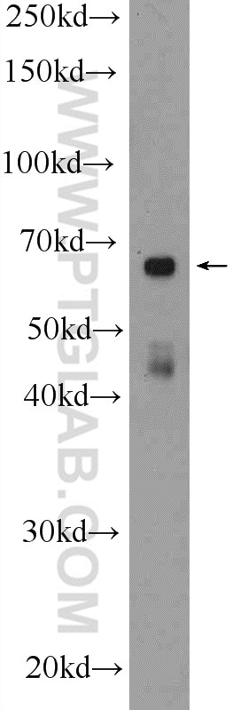 Western Blot (WB) analysis of SKOV-3 cells using LMF1 Polyclonal antibody (16812-1-AP)