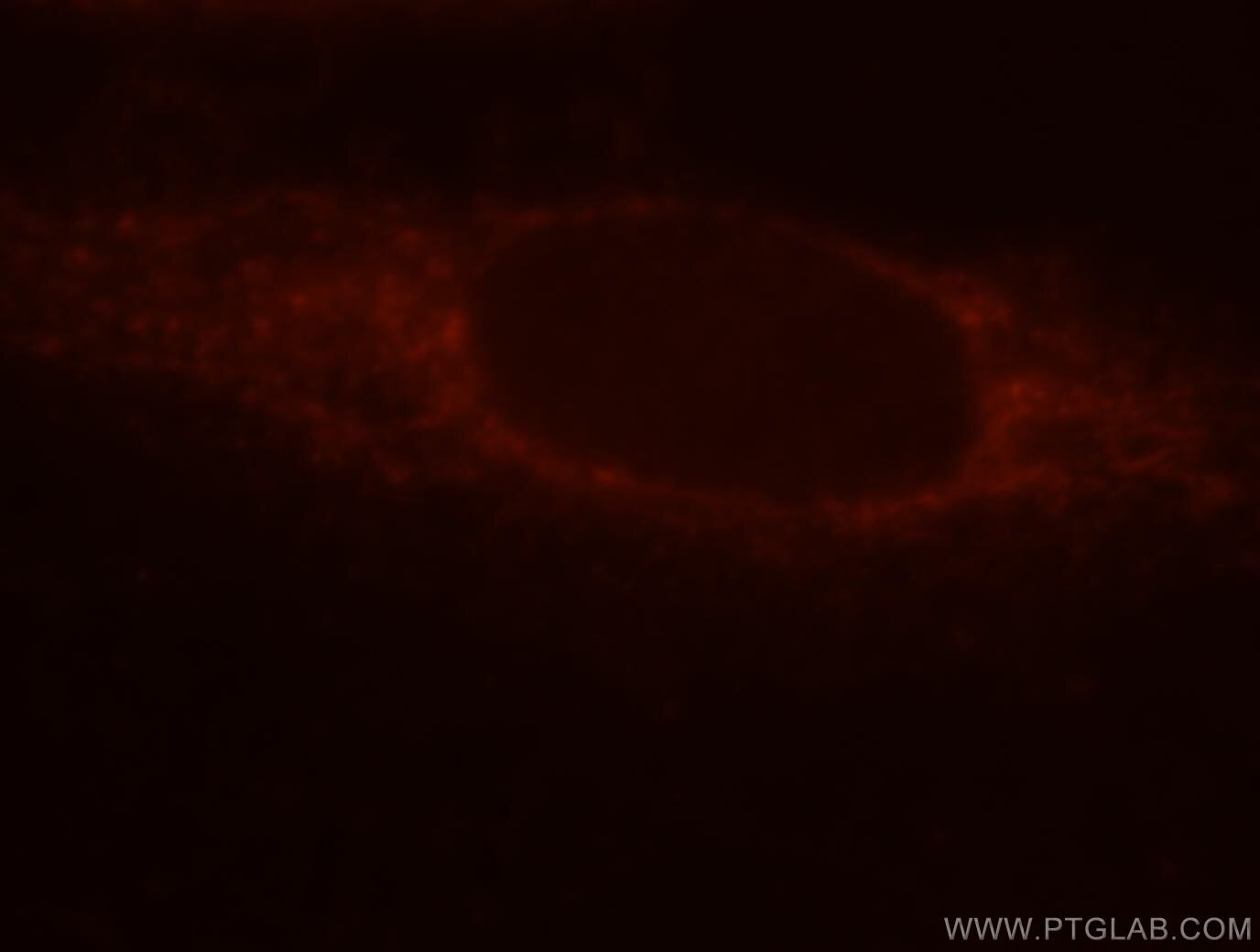 Immunofluorescence (IF) / fluorescent staining of MCF-7 cells using LMF2 Polyclonal antibody (16249-1-AP)