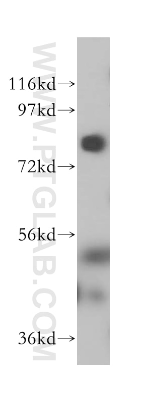 Western Blot (WB) analysis of HeLa cells using LMF2 Polyclonal antibody (16249-1-AP)