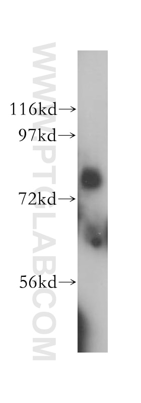 Western Blot (WB) analysis of human brain tissue using LMF2 Polyclonal antibody (16249-1-AP)