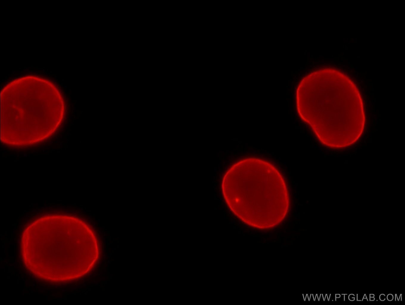 IF Staining of HepG2 using 12987-1-AP