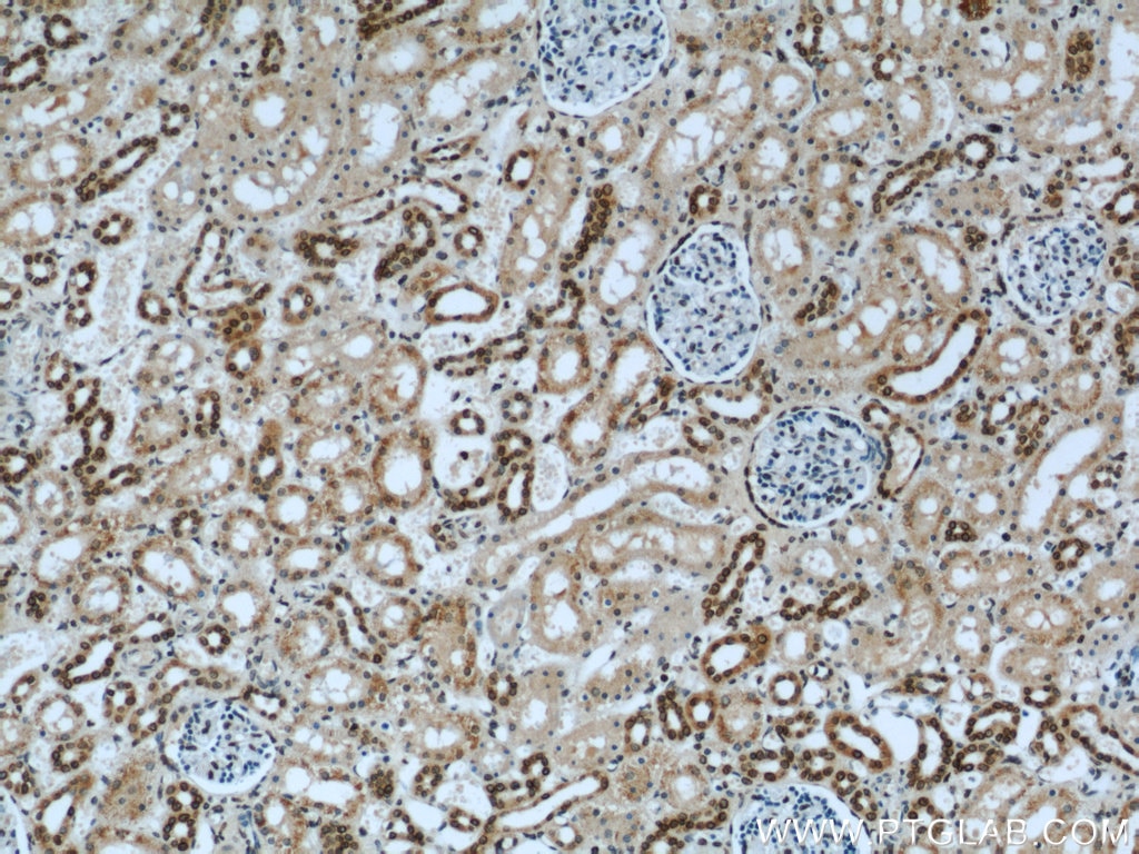 Immunohistochemistry (IHC) staining of human kidney tissue using Lamin B1 Polyclonal antibody (12987-1-AP)
