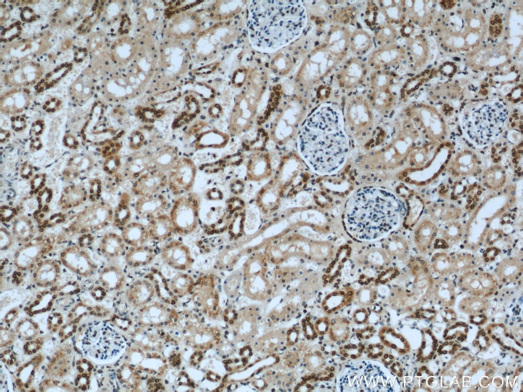 IHC staining of human kidney using 12987-1-AP