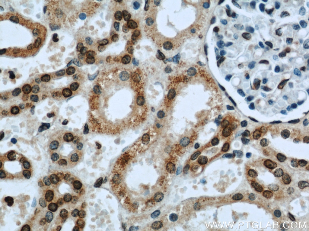 Immunohistochemistry (IHC) staining of human kidney tissue using Lamin B1 Polyclonal antibody (12987-1-AP)