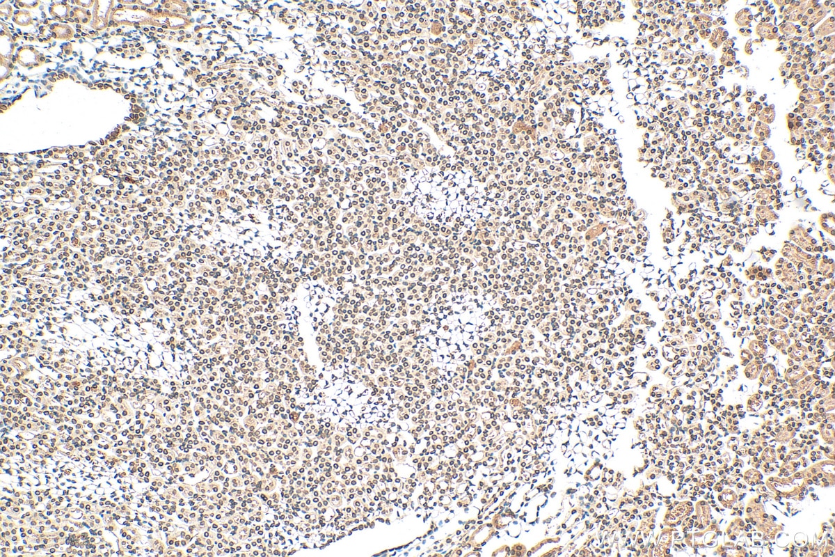 Immunohistochemistry (IHC) staining of mouse kidney tissue using Lamin B1 Polyclonal antibody (12987-1-AP)