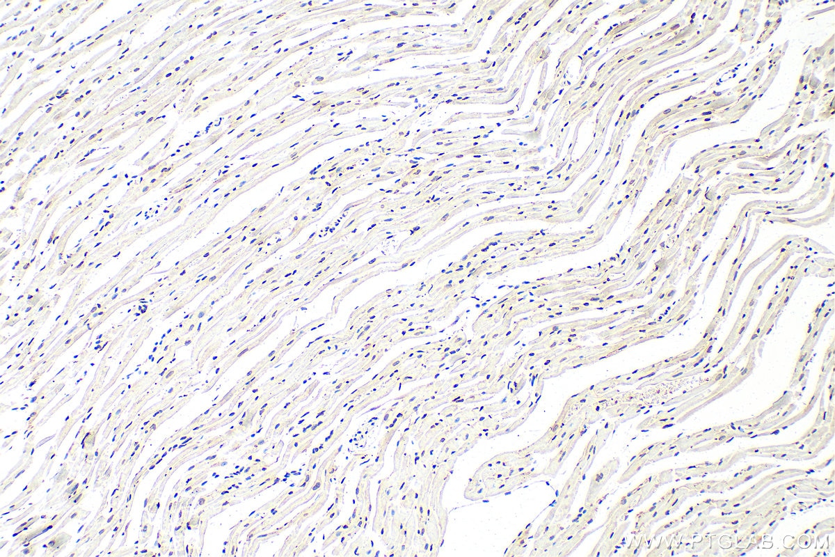 IHC staining of mouse heart using 12987-1-AP