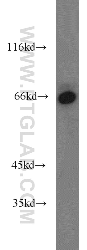 Western Blot (WB) analysis of K-562 cells using Lamin B1 Polyclonal antibody (12987-1-AP)