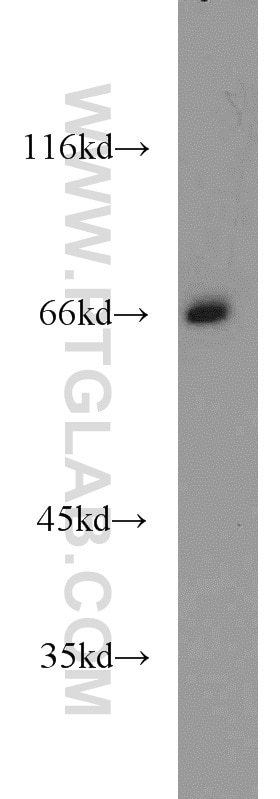 Western Blot (WB) analysis of Y79 cells using Lamin B1 Polyclonal antibody (12987-1-AP)
