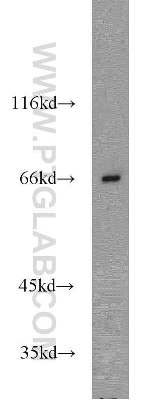 Western Blot (WB) analysis of mouse eye tissue using Lamin B1 Polyclonal antibody (12987-1-AP)