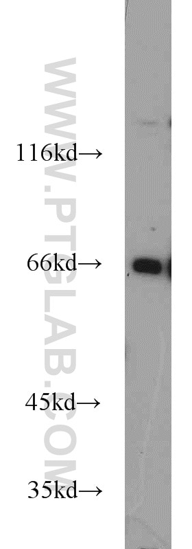 Western Blot (WB) analysis of mouse kidney tissue using Lamin B1 Polyclonal antibody (12987-1-AP)