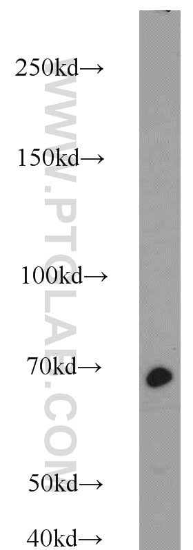 Western Blot (WB) analysis of mouse pancreas tissue using Lamin B1 Polyclonal antibody (12987-1-AP)