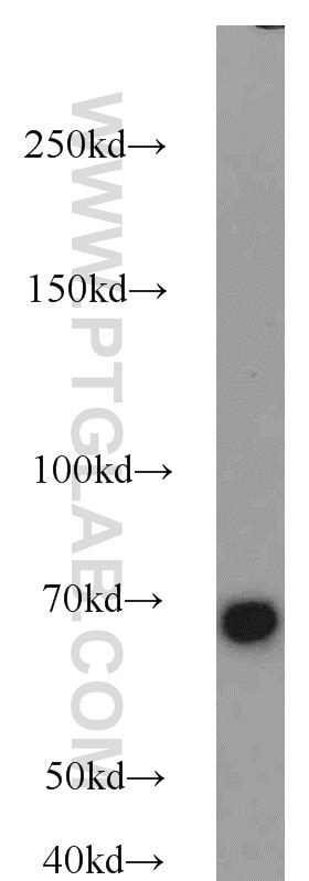 Western Blot (WB) analysis of SH-SY5Y cells using Lamin B1 Polyclonal antibody (12987-1-AP)