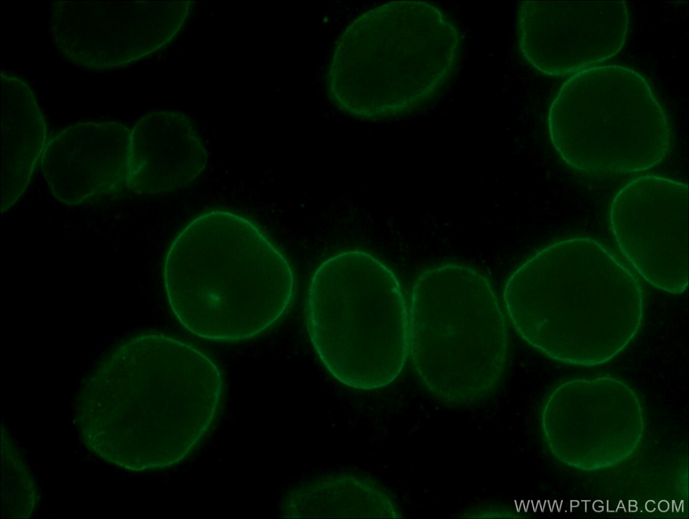 Immunofluorescence (IF) / fluorescent staining of HeLa cells using Lamin B1 Monoclonal antibody (66095-1-Ig)