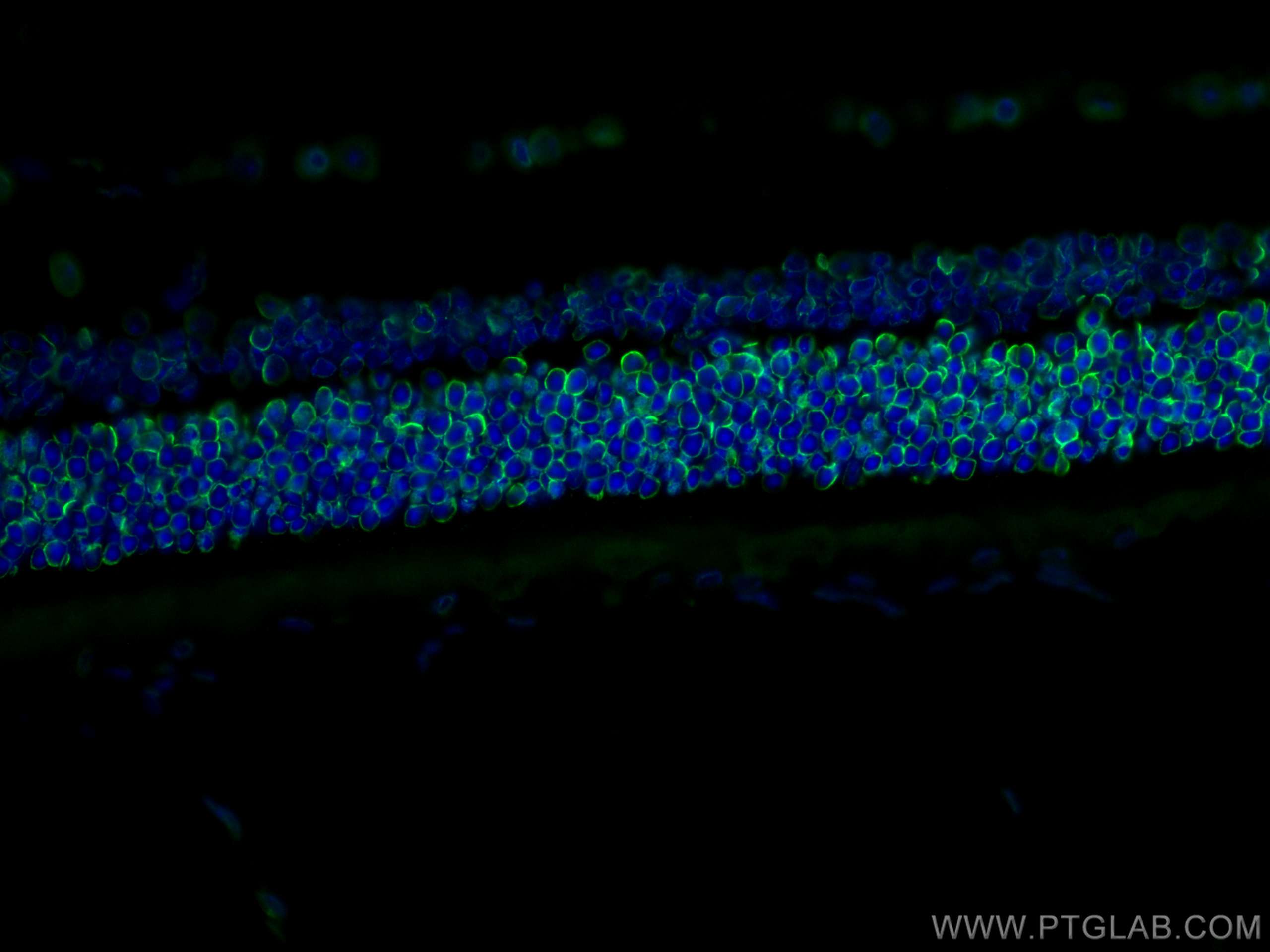 Immunofluorescence (IF) / fluorescent staining of mouse eye tissue using Lamin B1 Monoclonal antibody (66095-1-Ig)