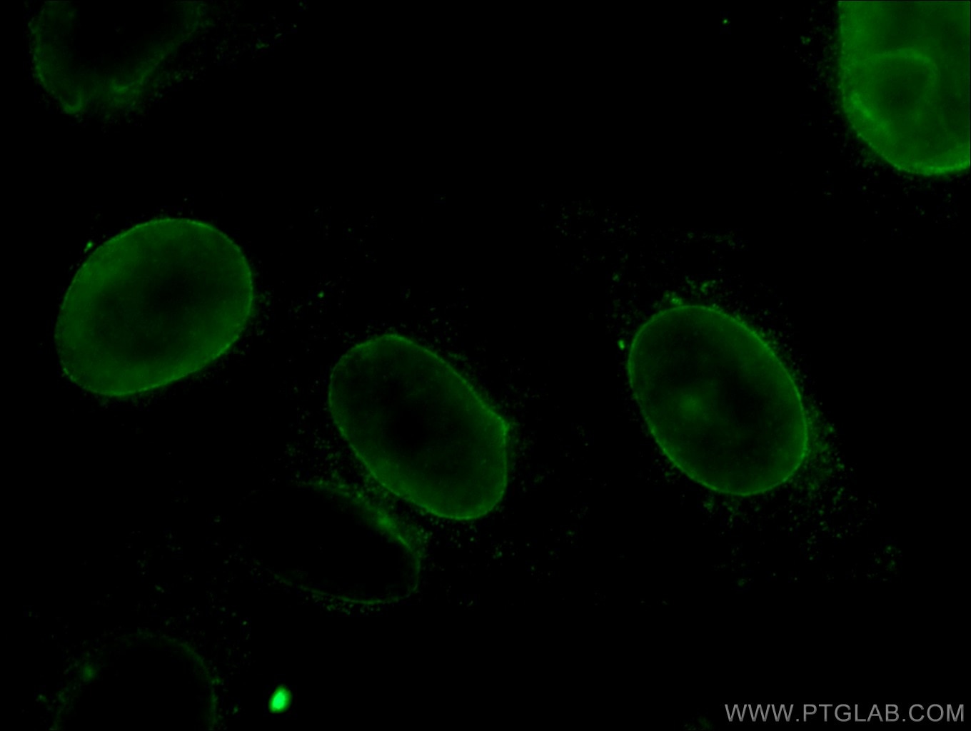 Lamin B1 Monoclonal antibody