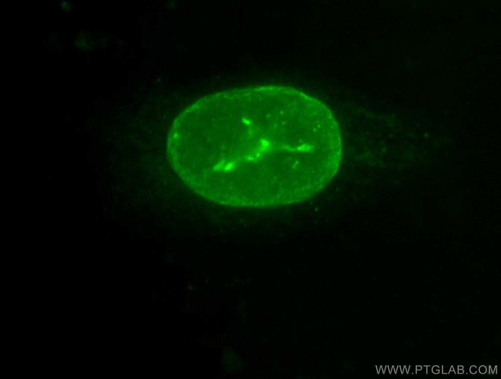 Immunofluorescence (IF) / fluorescent staining of SH-SY5Y cells using Lamin B2 Polyclonal antibody (10895-1-AP)