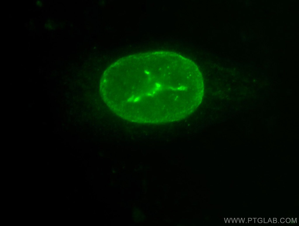 IF Staining of SH-SY5Y using 10895-1-AP