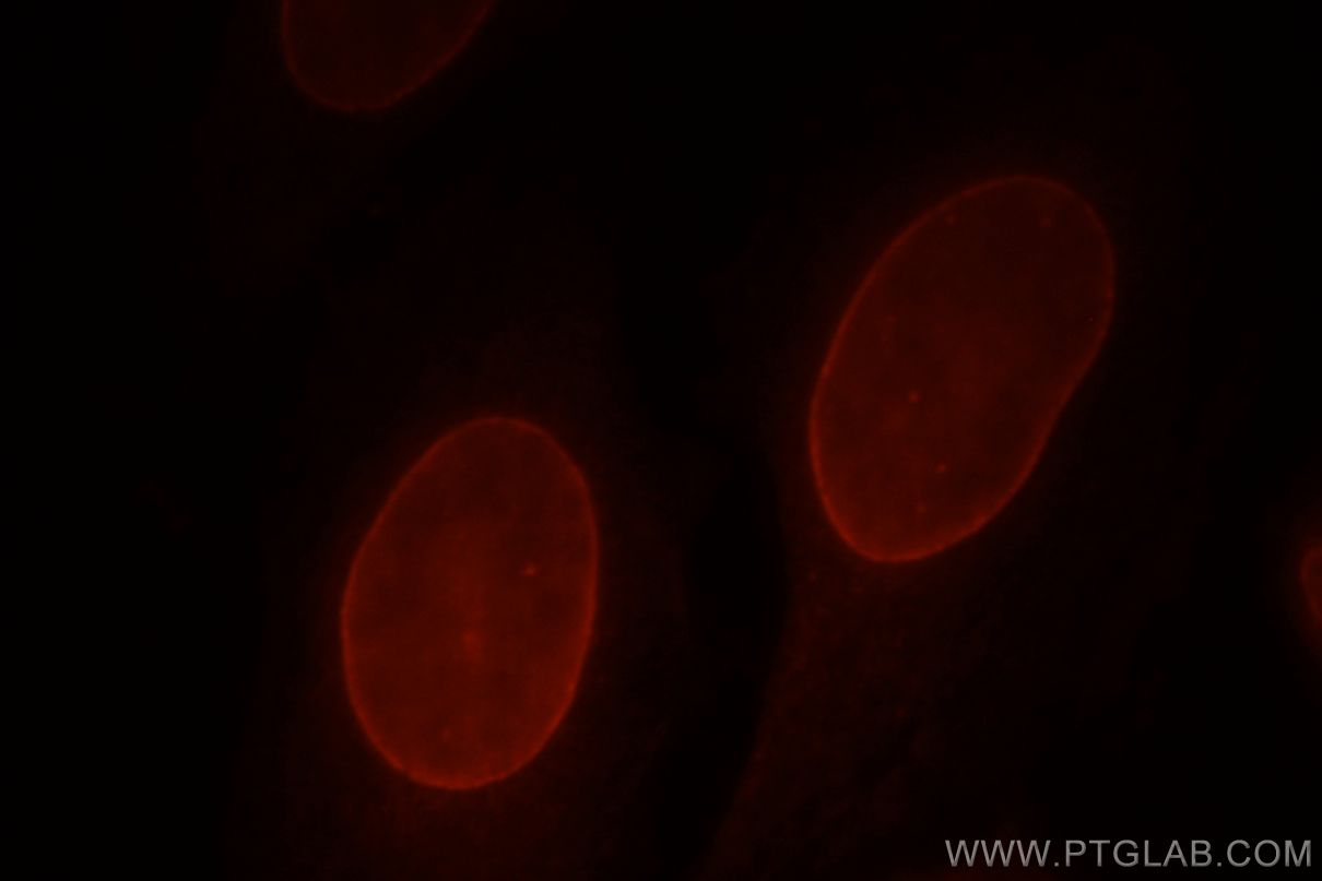 IF Staining of HepG2 using 10895-1-AP