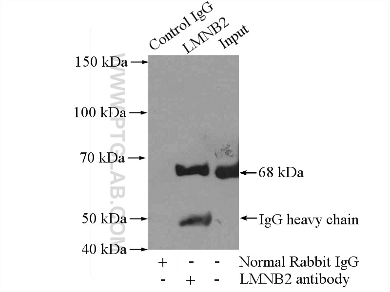 Immunoprecipitation (IP) experiment of Jurkat cells using Lamin B2 Polyclonal antibody (10895-1-AP)