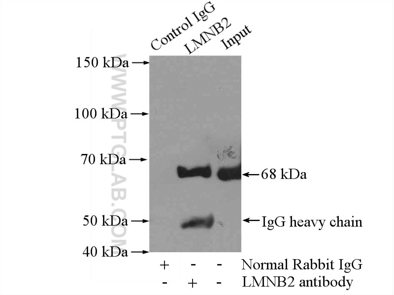 IP experiment of Jurkat using 10895-1-AP