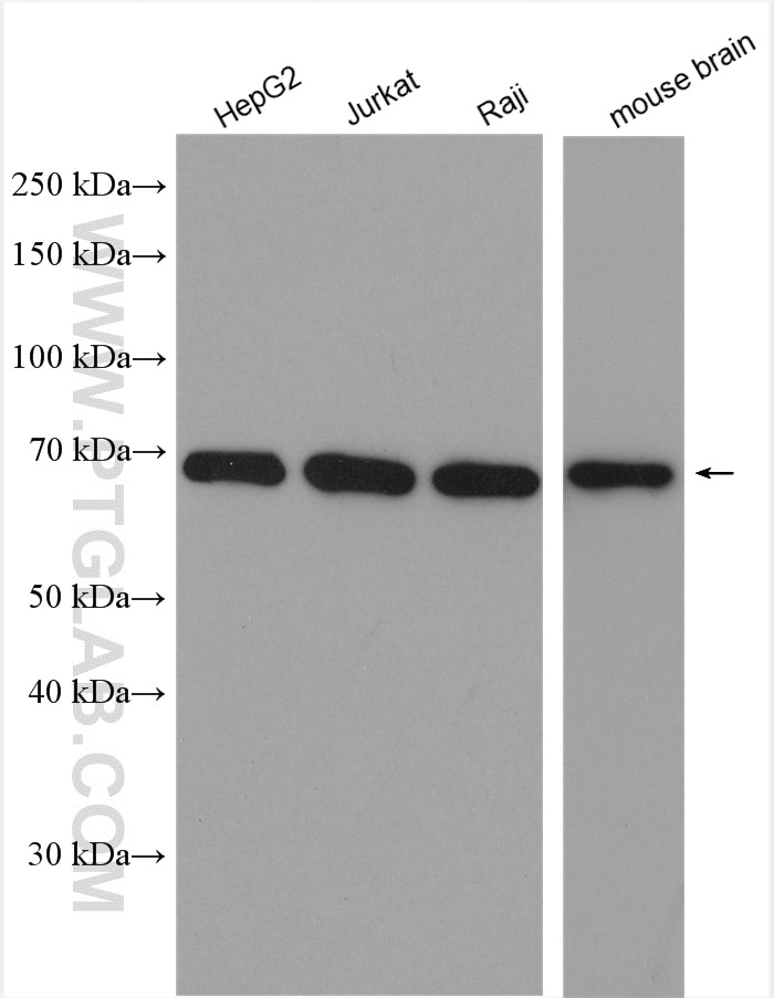 Western Blot (WB) analysis of various lysates using Lamin B2 Polyclonal antibody (10895-1-AP)