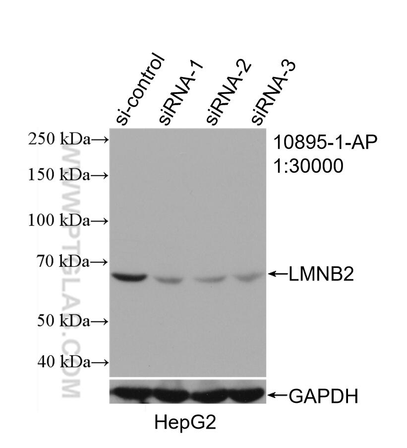 Western Blot (WB) analysis of HepG2 cells using Lamin B2 Polyclonal antibody (10895-1-AP)