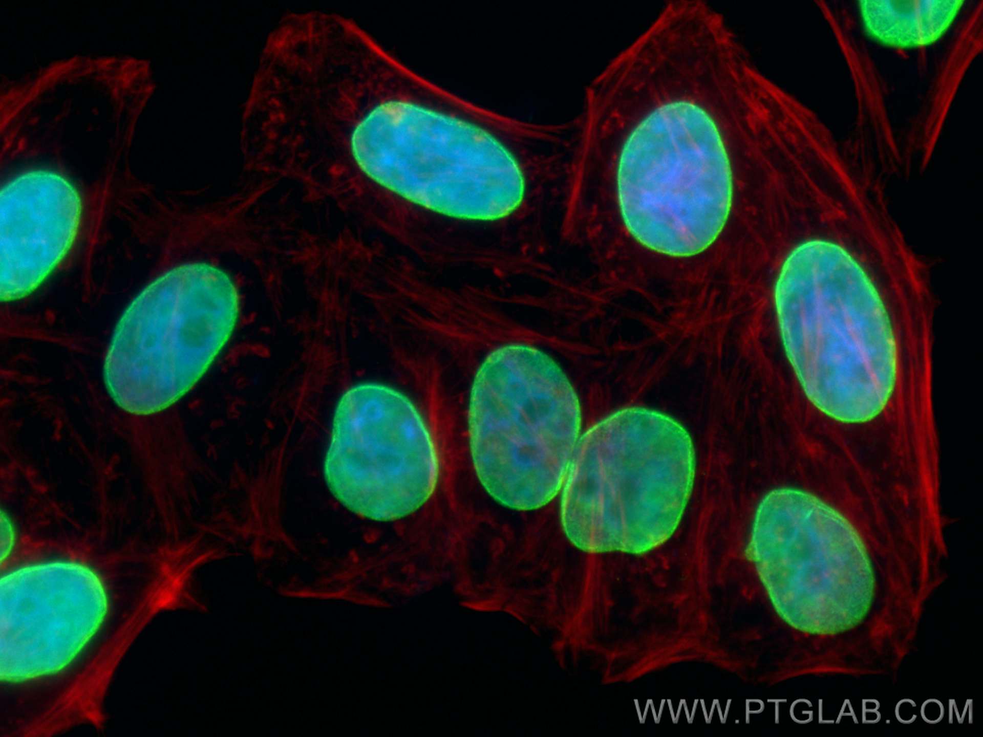 IF Staining of HepG2 using 82801-3-RR