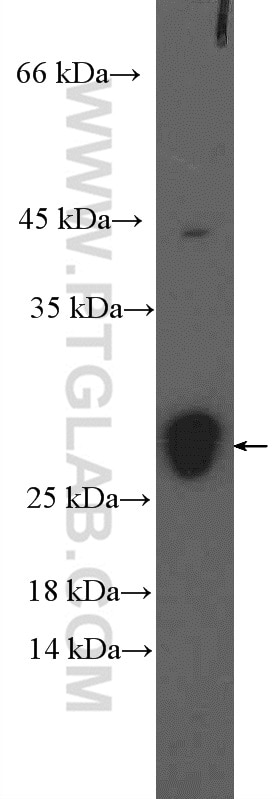 Western Blot (WB) analysis of mouse heart tissue using LMO2 Polyclonal antibody (21966-1-AP)