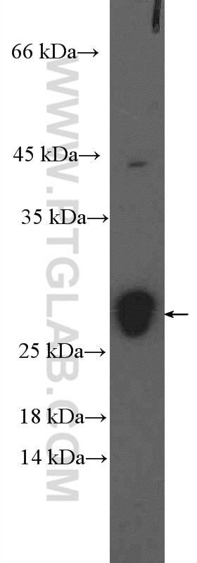 WB analysis of mouse heart using 21966-1-AP