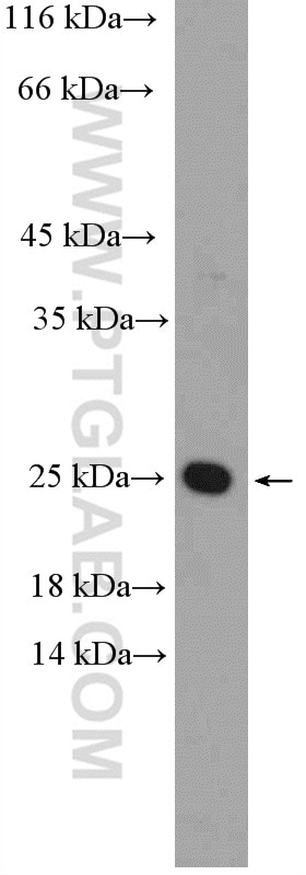 Western Blot (WB) analysis of mouse heart tissue using LMO2 Polyclonal antibody (21966-1-AP)