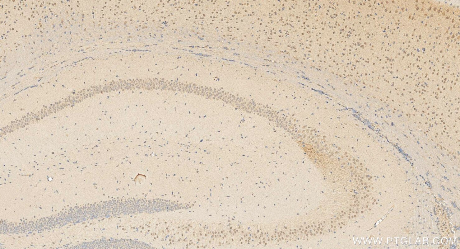 IHC staining of mouse brain using 12146-1-AP Immunohistochemistry (IHC) staining of mouse brain tissue using LMO4 Polyclonal antibody (12146-1-AP)