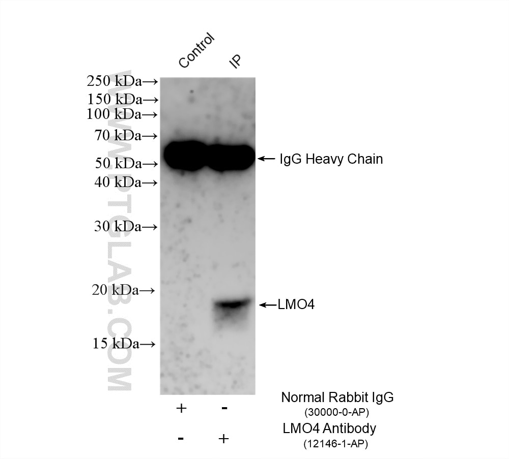 IP experiment of T-47D using 12146-1-AP Immunoprecipitation (IP) experiment of T-47D cells using LMO4 Polyclonal antibody (12146-1-AP)