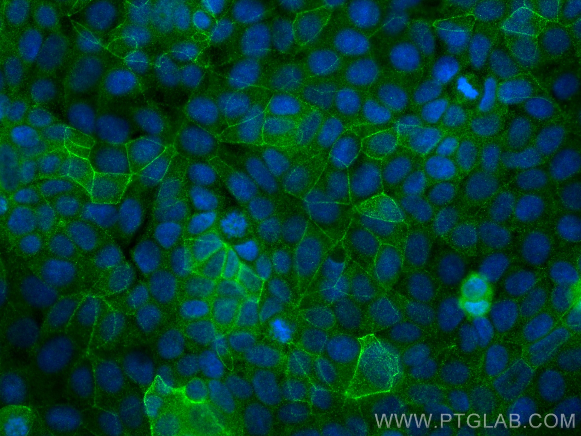 Immunofluorescence (IF) / fluorescent staining of MCF-7 cells using LMO7 Polyclonal antibody (29392-1-AP)