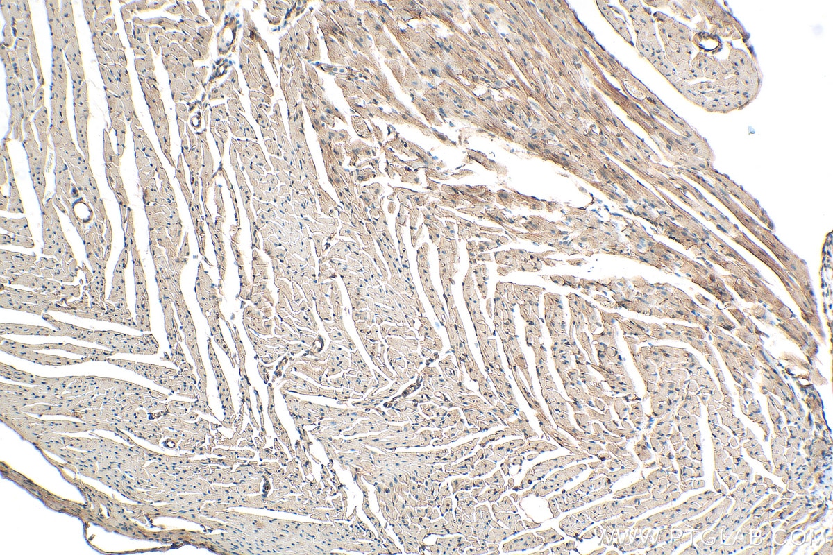 Immunohistochemistry (IHC) staining of mouse heart tissue using LMO7 Polyclonal antibody (29392-1-AP)