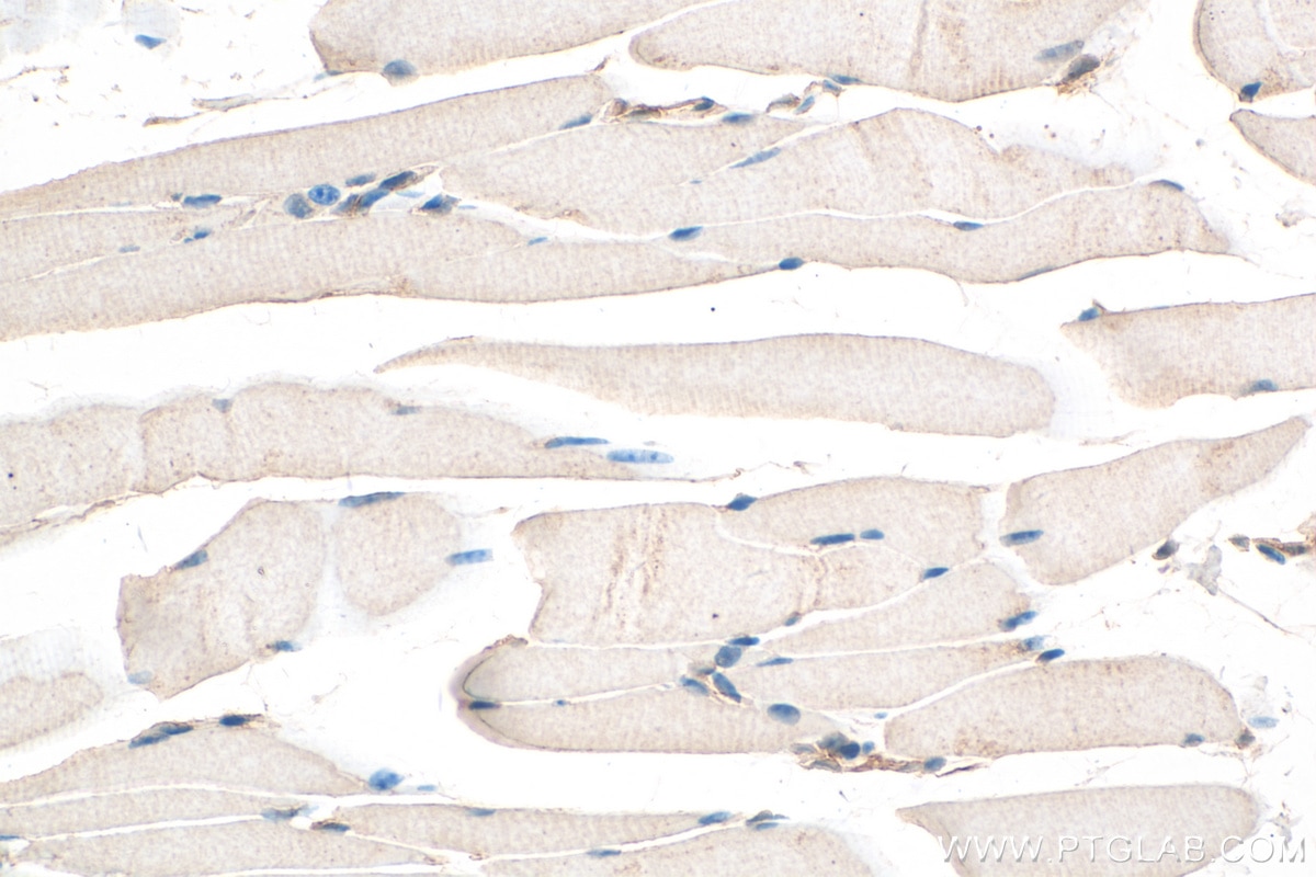 Immunohistochemistry (IHC) staining of mouse skeletal muscle tissue using LMO7 Polyclonal antibody (29392-1-AP)