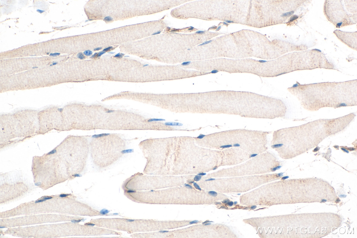 IHC staining of mouse skeletal muscle using 29392-1-AP