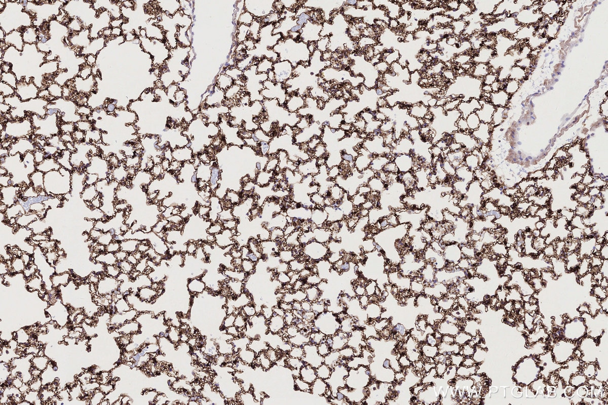 Immunohistochemistry (IHC) staining of mouse lung tissue using LMO7 Recombinant monoclonal antibody (84495-4-RR)